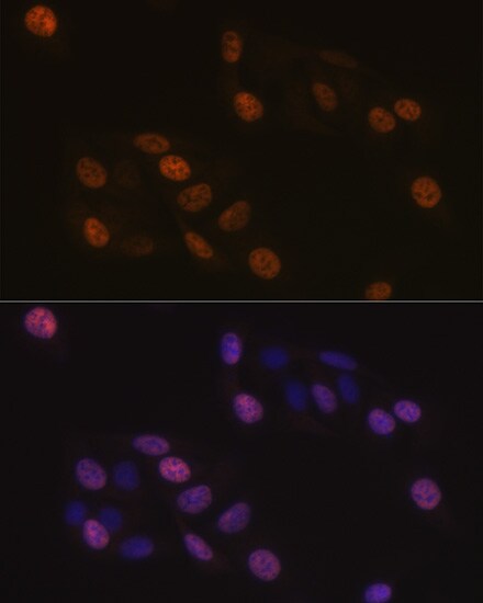 KIFC1 Antibody (10M10J4)
