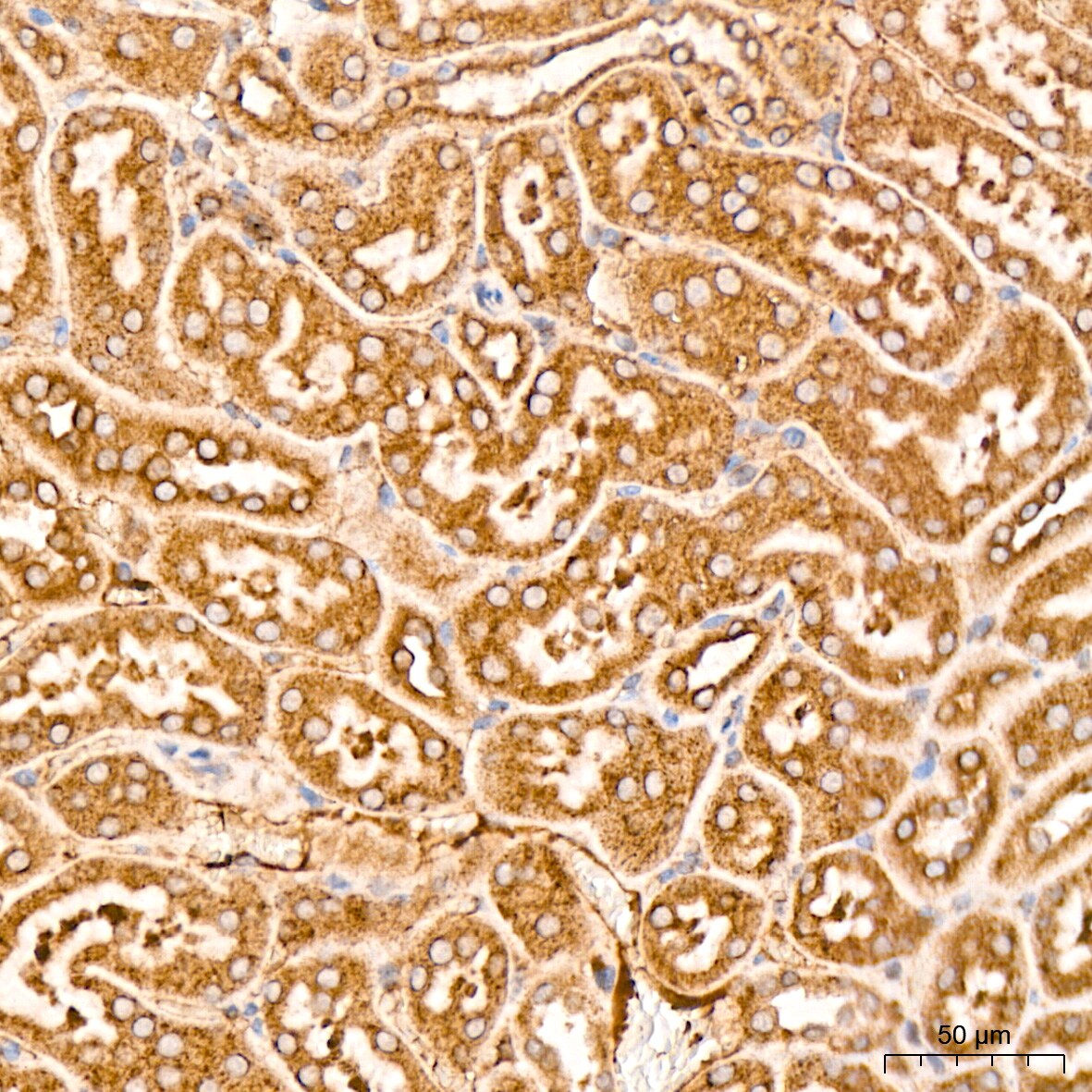 MSP/MST1 Antibody (5R7X2)