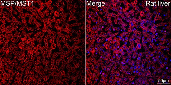 MSP/MST1 Antibody (5R7X2)