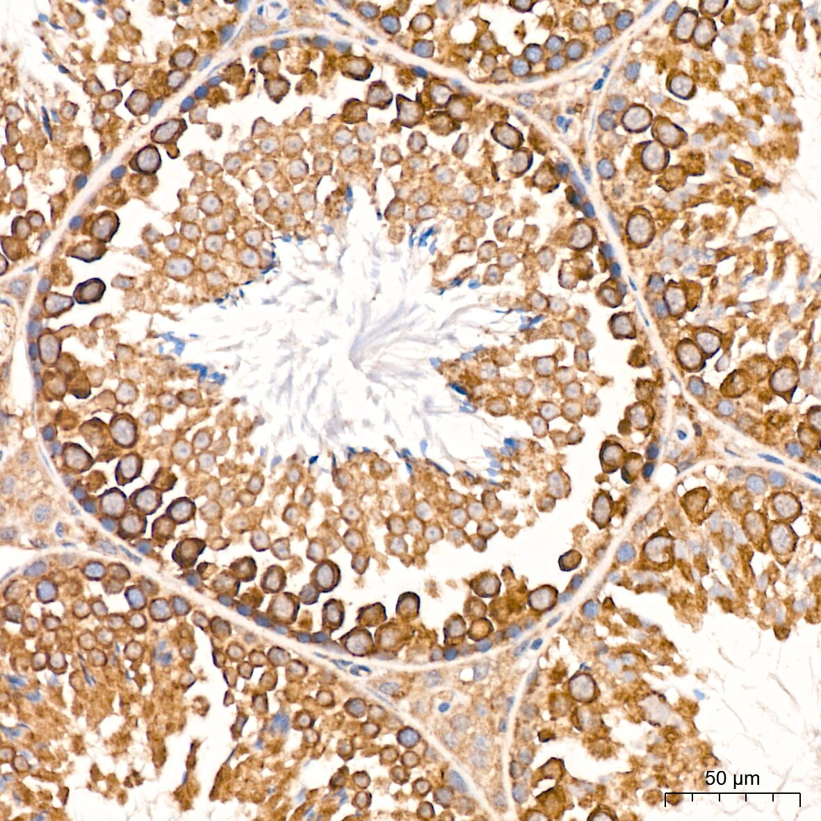 MSP/MST1 Antibody (5R7X2)
