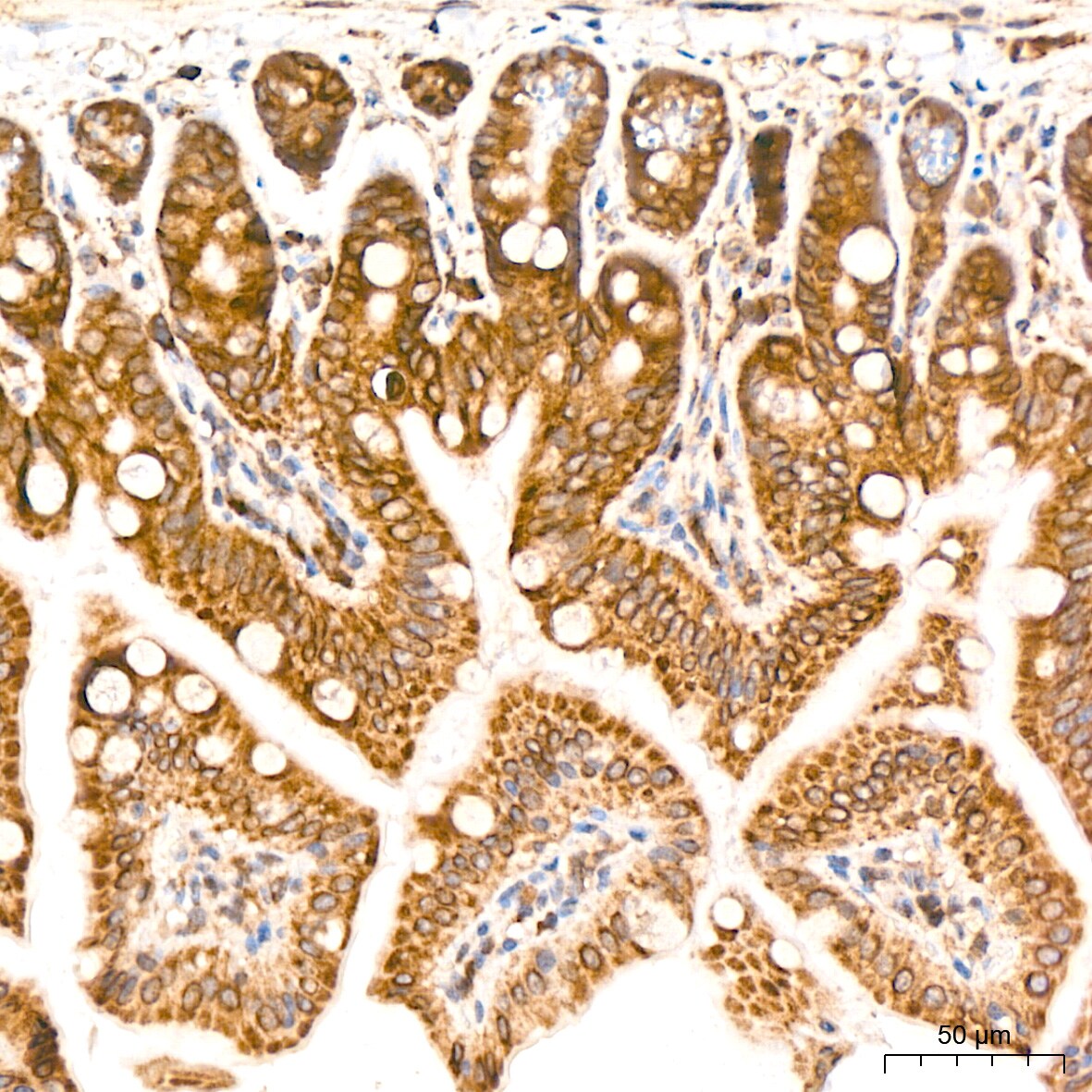 MSP/MST1 Antibody (5R7X2)