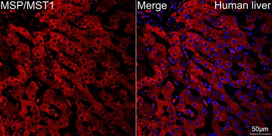 MSP/MST1 Antibody (5R7X2)