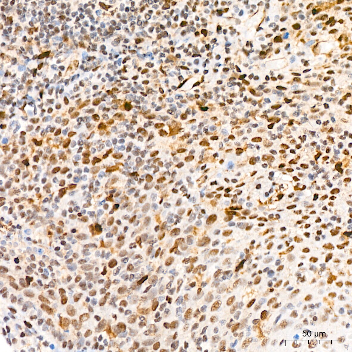QKI/Quaking Antibody (1D1N6)