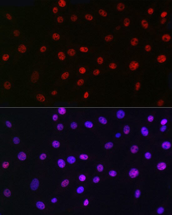 QKI/Quaking Antibody (1D1N6)