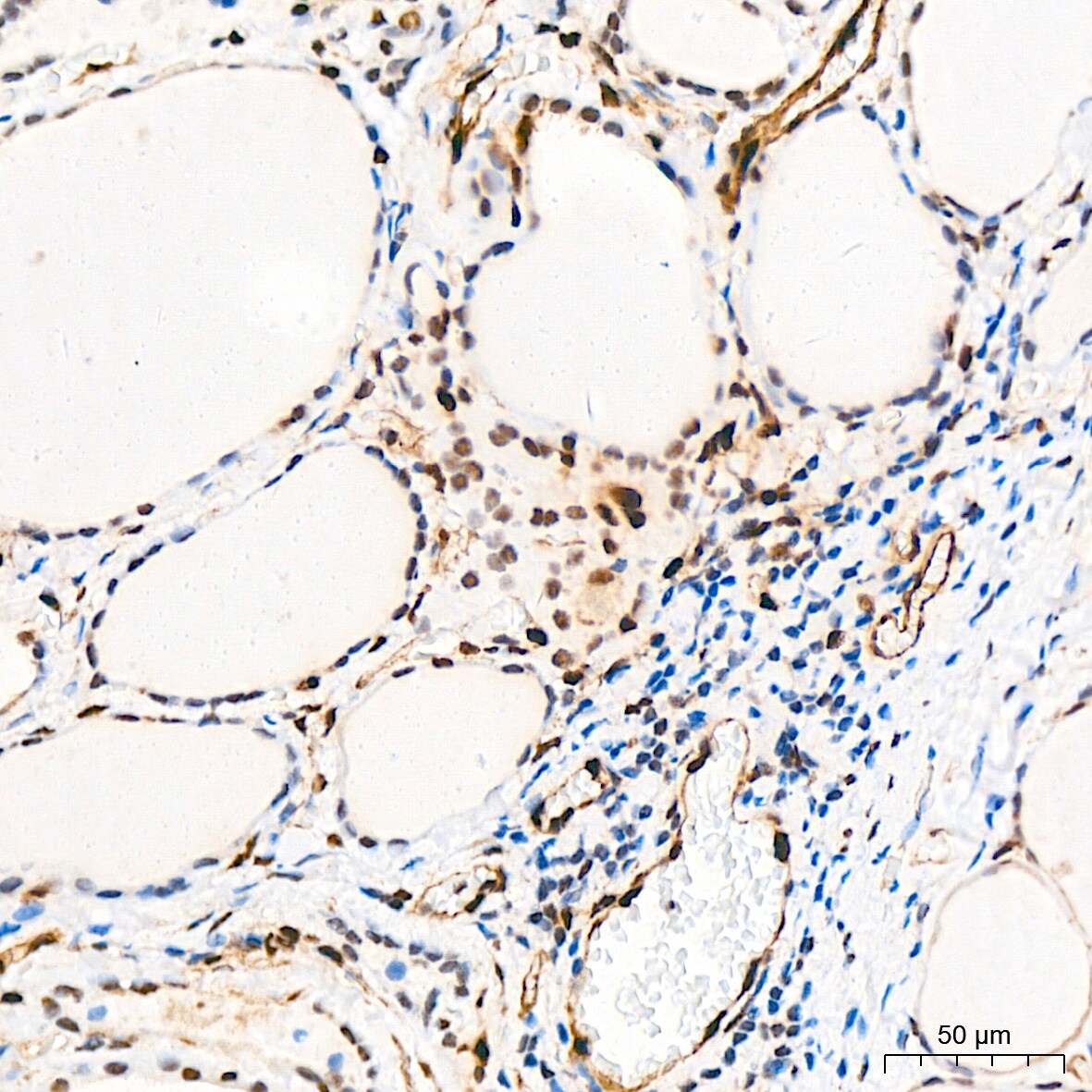 QKI/Quaking Antibody (1D1N6)