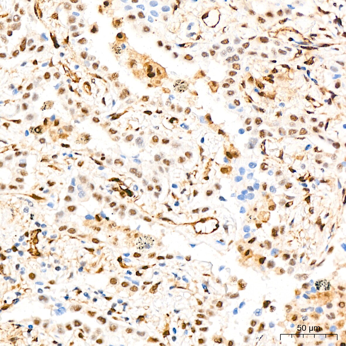 QKI/Quaking Antibody (1D1N6)