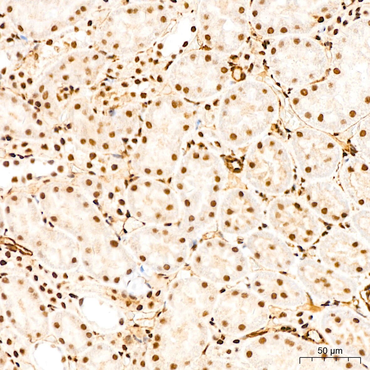 QKI/Quaking Antibody (1D1N6)