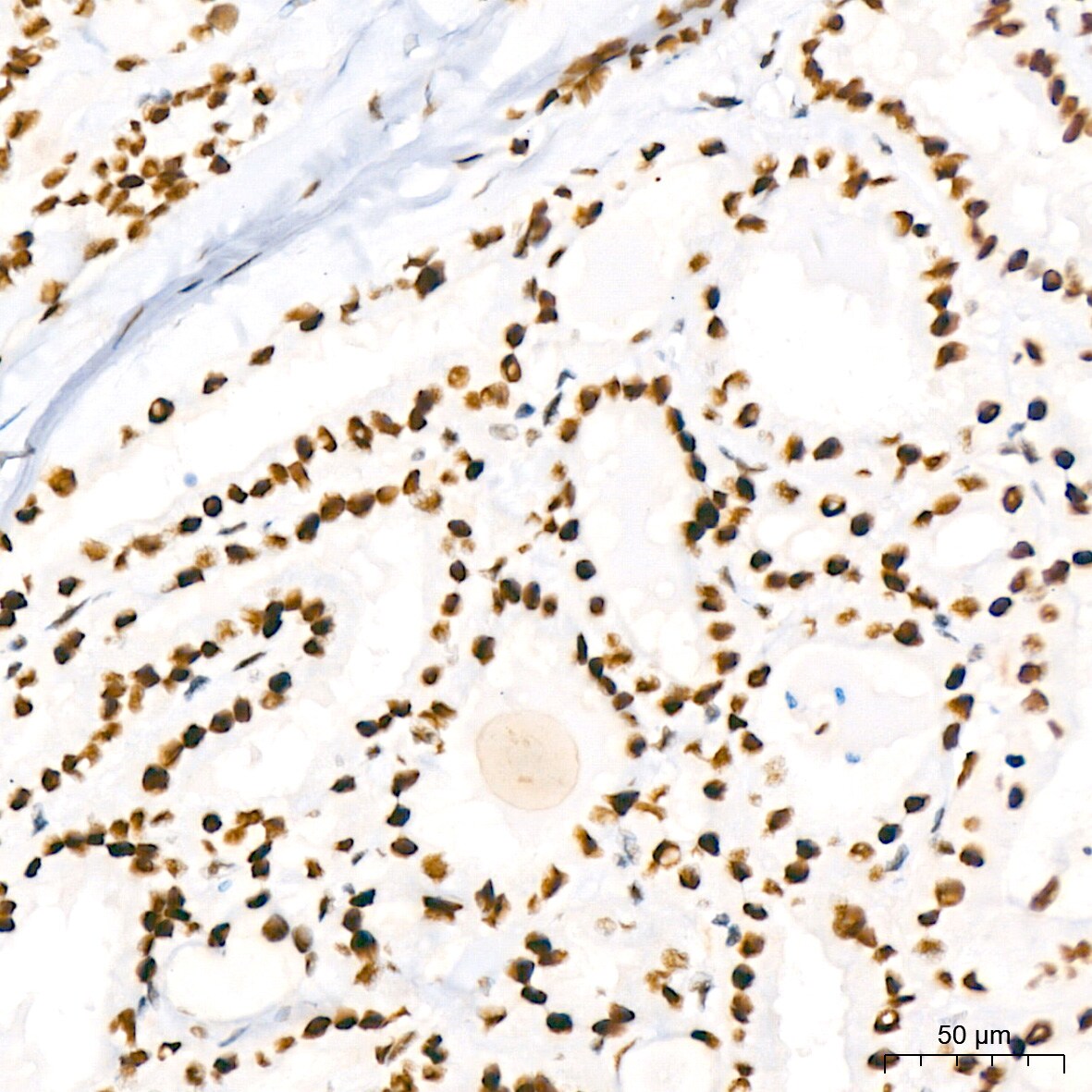 BAF180/PB1 Antibody (9A8C4)