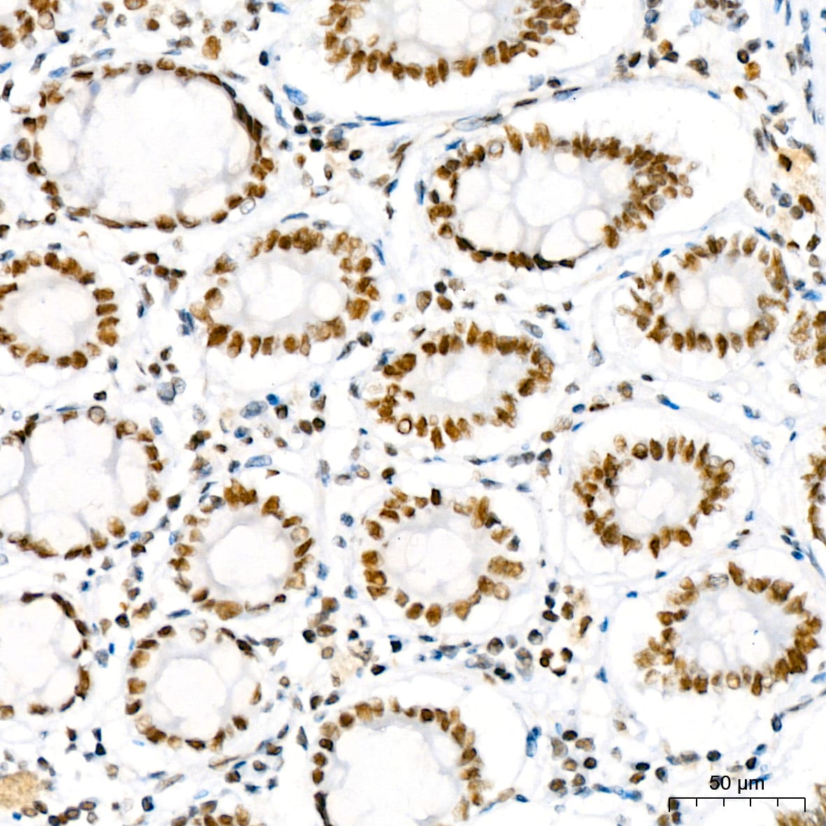 BAF180/PB1 Antibody (9A8C4)