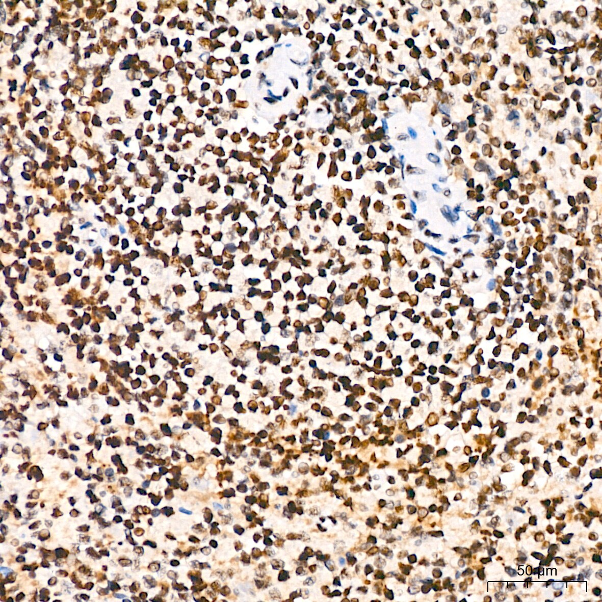 BAF180/PB1 Antibody (9A8C4)