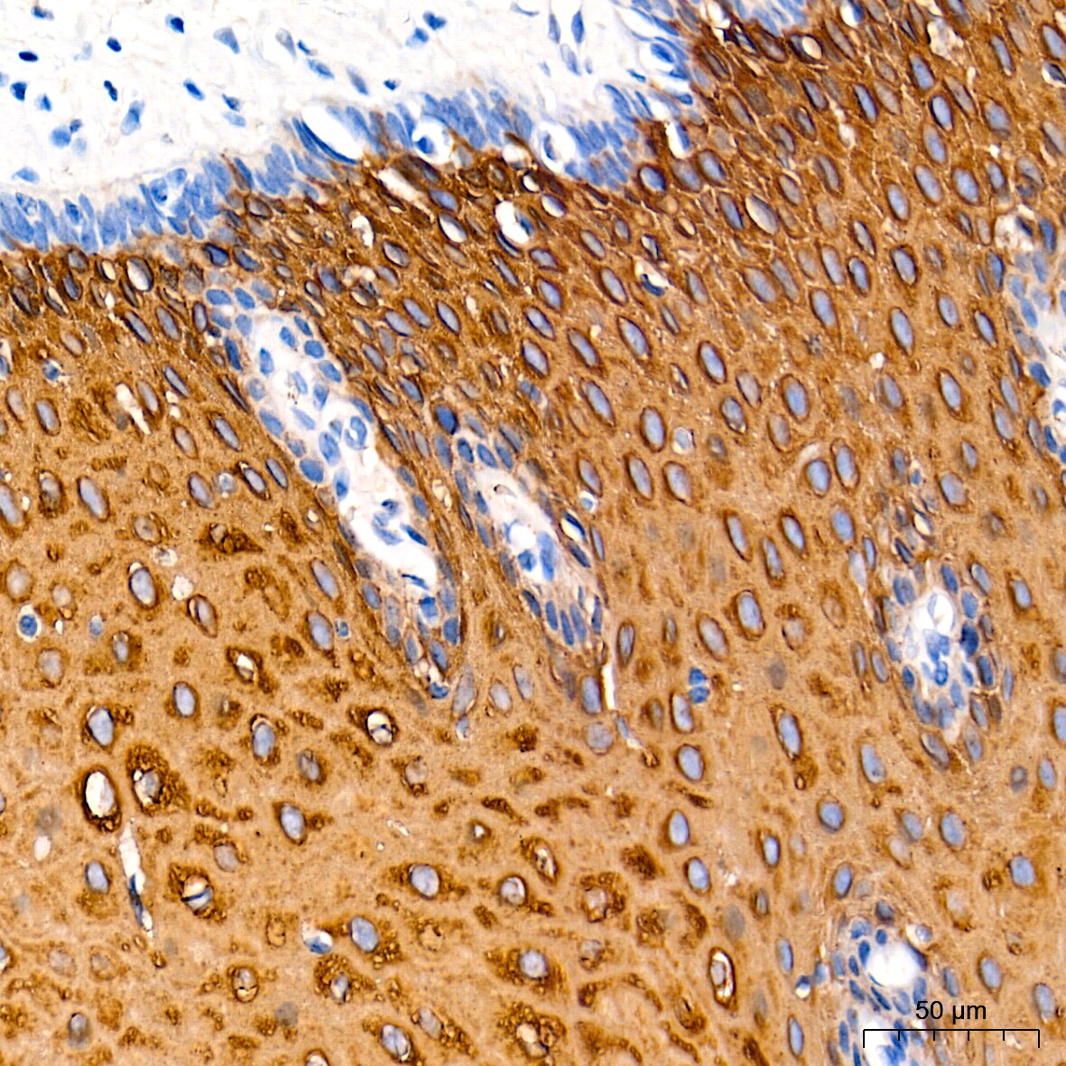 Cytokeratin 13 Antibody (5M6B10)