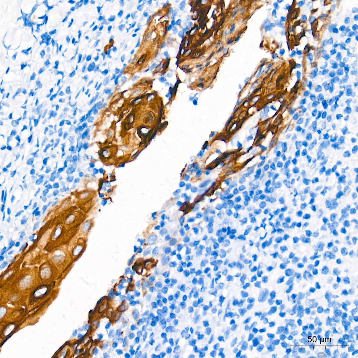 Cytokeratin 13 Antibody (5M6B10)