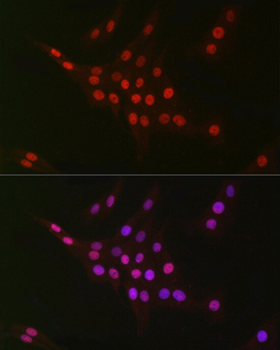 CTBP2 Antibody (1R1U6)