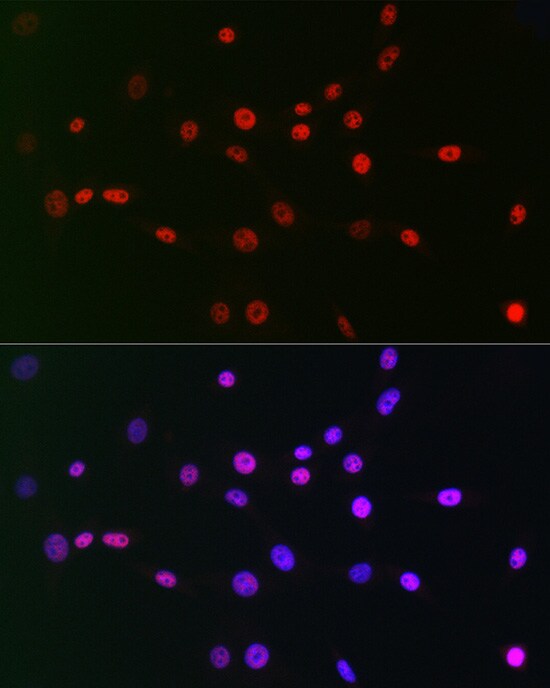 CTBP2 Antibody (1R1U6)