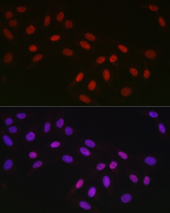 CTBP2 Antibody (1R1U6)