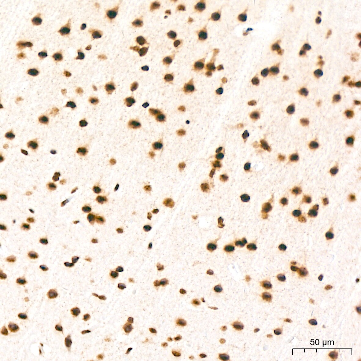 HR6B/UBE2B Antibody (2Z3R2)