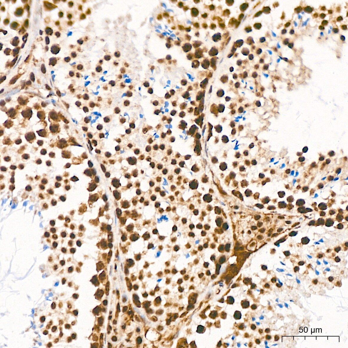 HR6B/UBE2B Antibody (2Z3R2)
