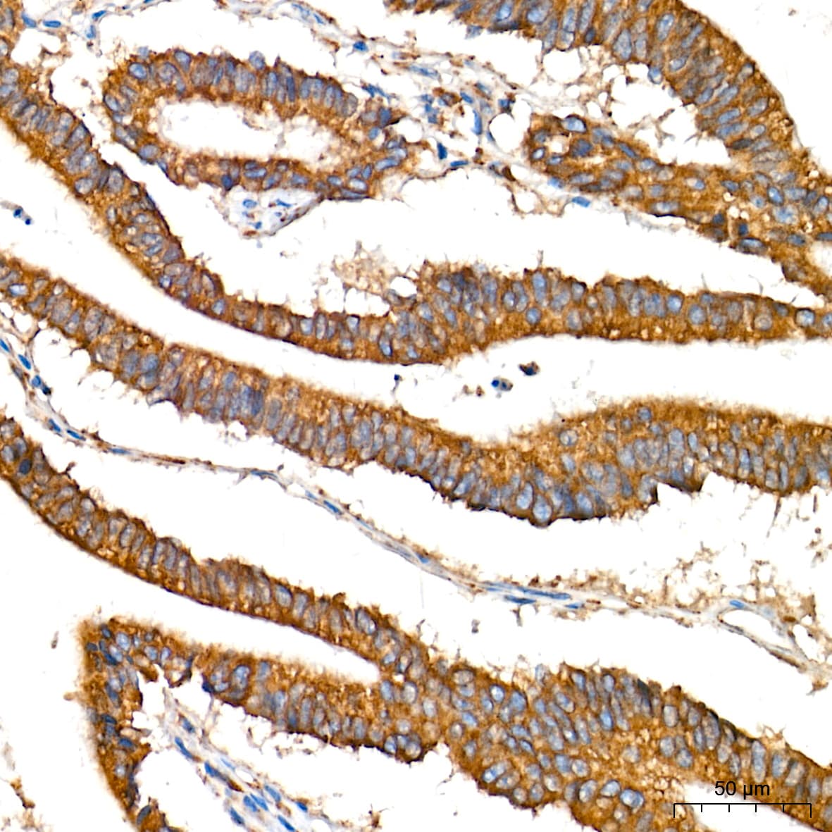 Alkaline Phosphatase/ALPL Antibody (10B1M5)