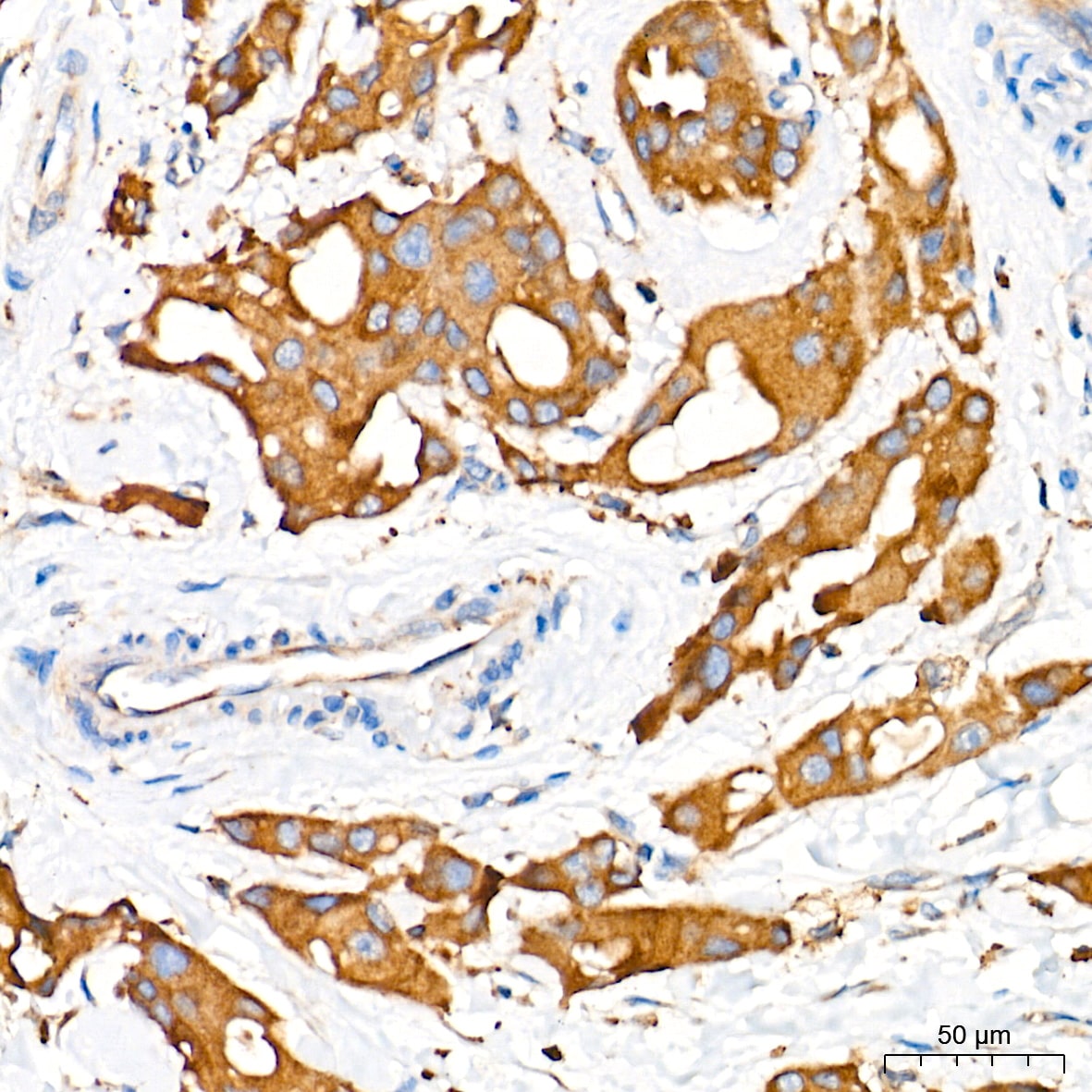 Alkaline Phosphatase/ALPL Antibody (10B1M5)