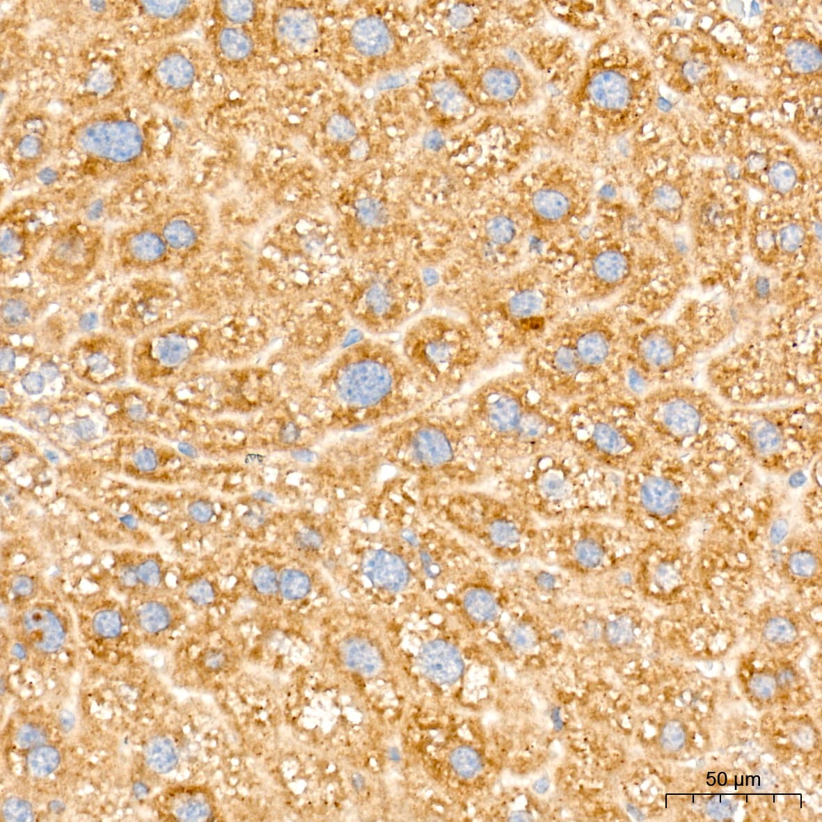 Alkaline Phosphatase/ALPL Antibody (10B1M5)