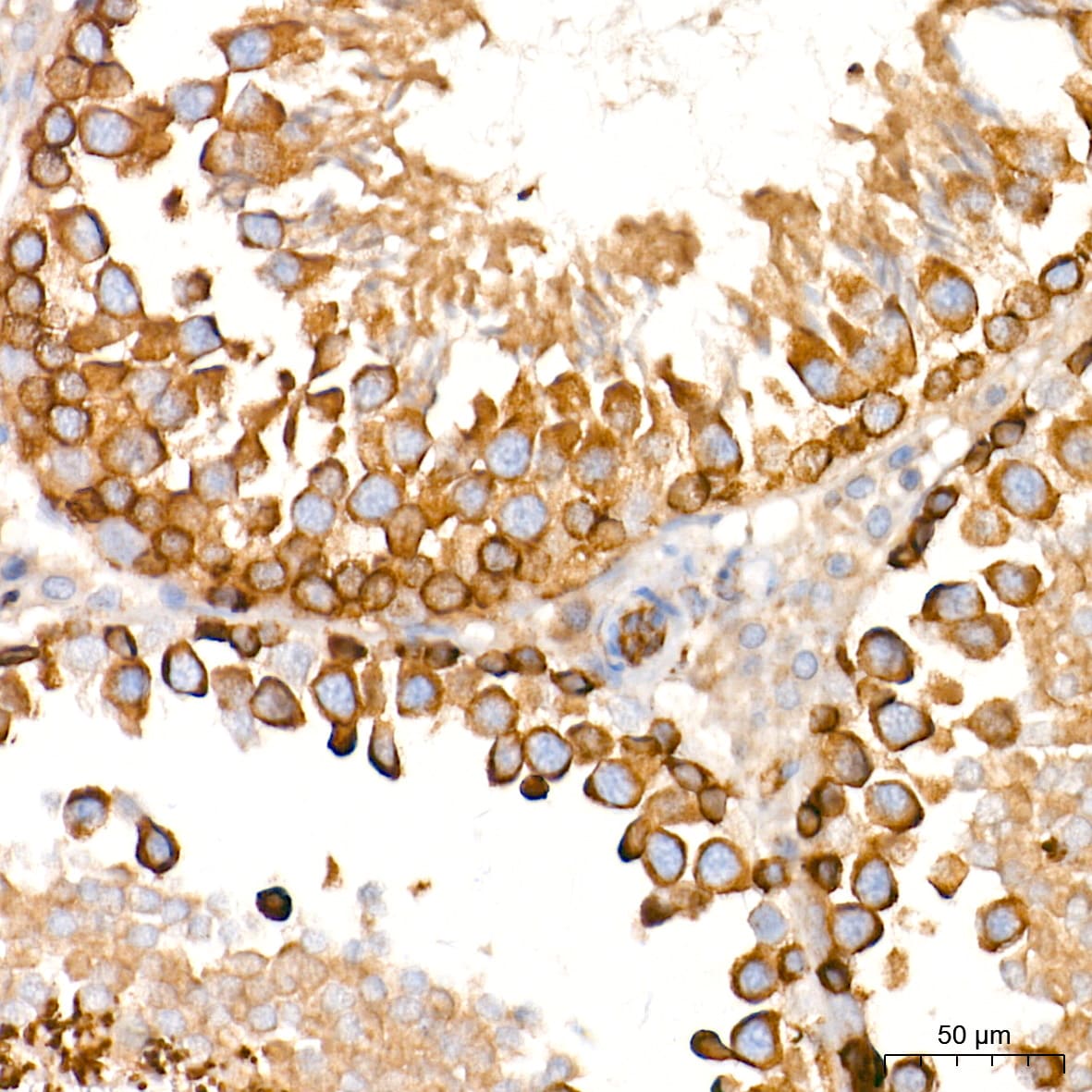 Alkaline Phosphatase/ALPL Antibody (10B1M5)