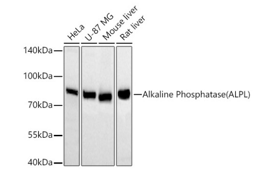 Alkaline Phosphatase/ALPL Antibody (10B1M5)