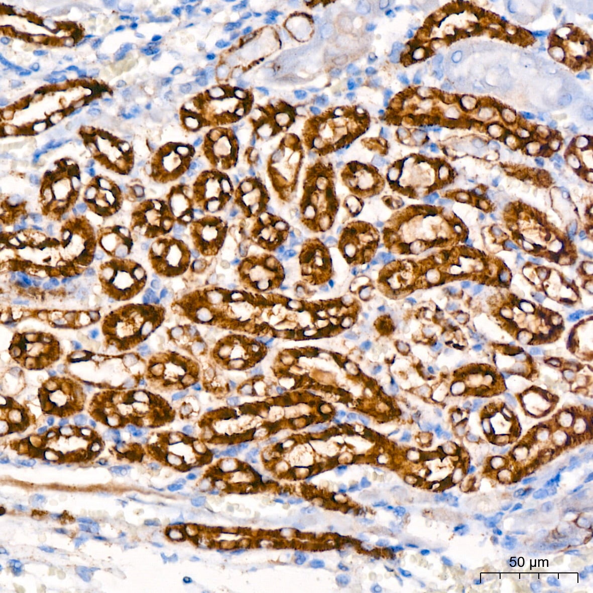 Hexokinase 1 Antibody (6B7Q2)