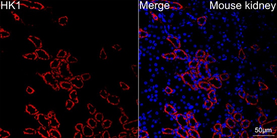 Hexokinase 1 Antibody (6B7Q2)