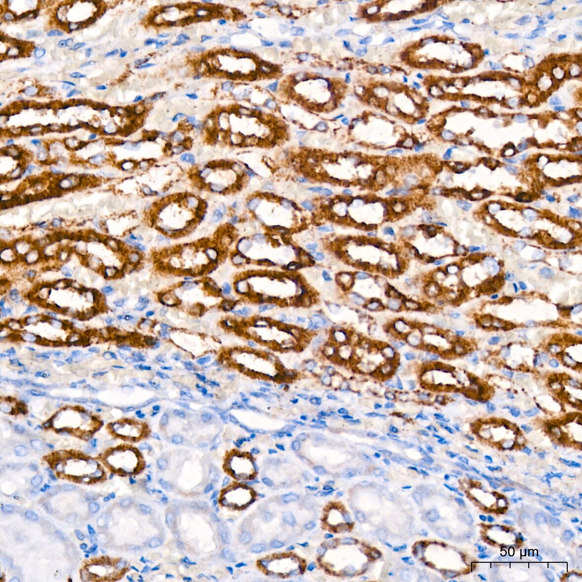 Hexokinase 1 Antibody (6B7Q2)