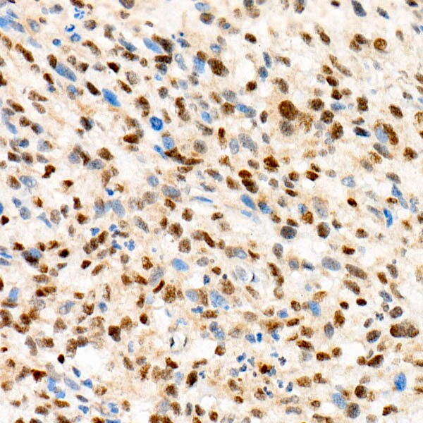 Transcription factor E3 Antibody (1O9E9)