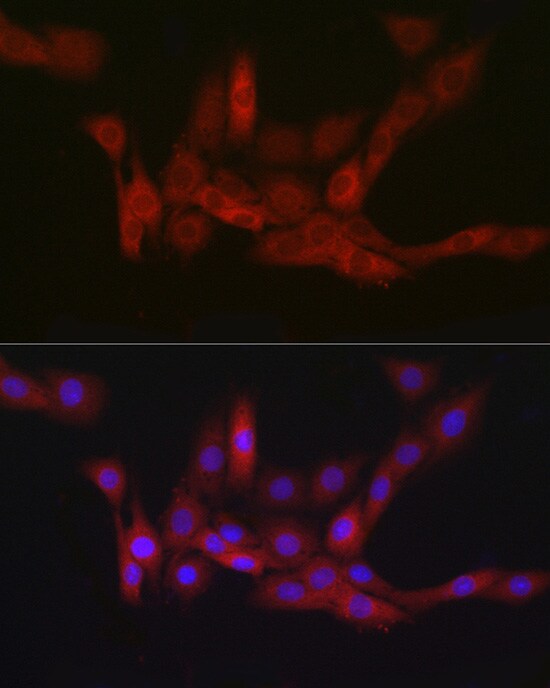 PGD Antibody (9A2M7)