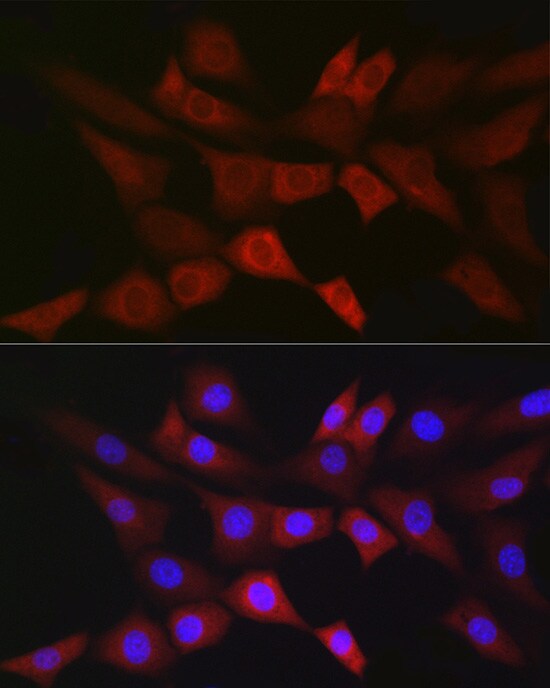 PGD Antibody (9A2M7)