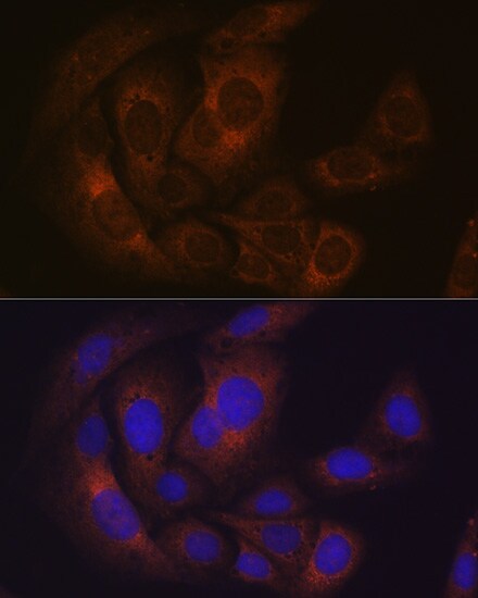 PUM1 Antibody (8Y6H5)