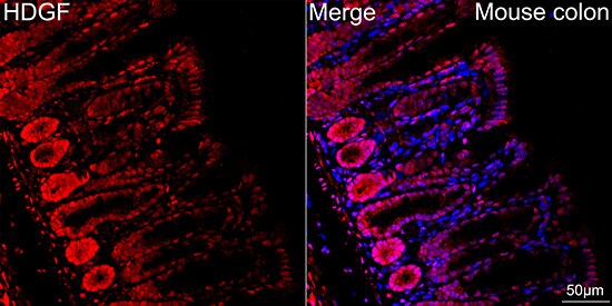 HDGF Antibody (5U7A7)