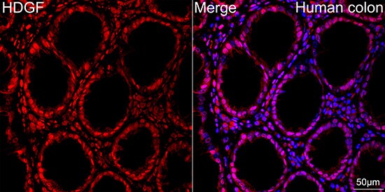 HDGF Antibody (5U7A7)