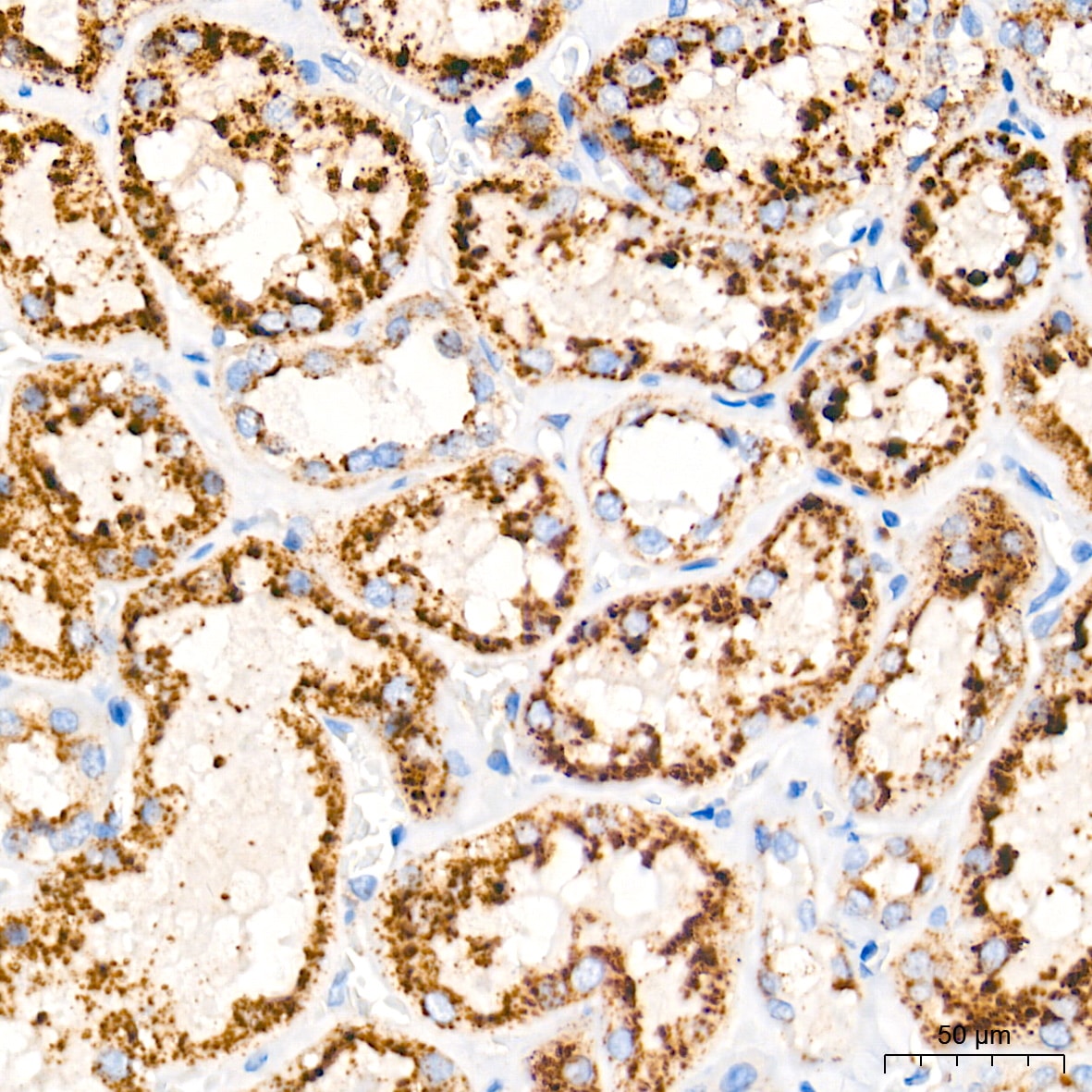 LAMP-2/CD107b Antibody (5N8J3)