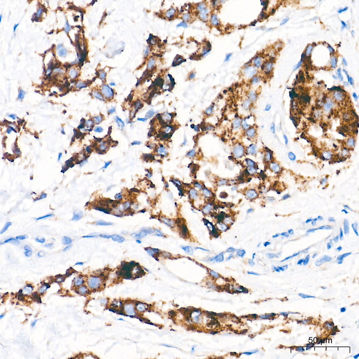 LAMP-2/CD107b Antibody (5N8J3)
