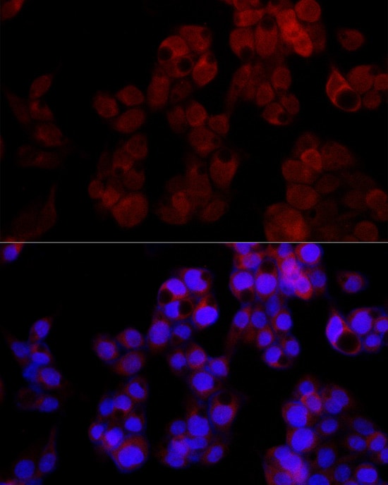 ADP-Sugar Pyrophosphatase/NUDT5 Antibody (7Y9M2)