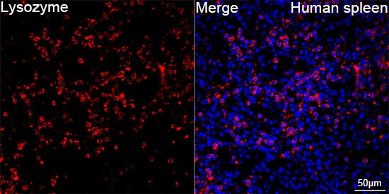 Lysozyme Antibody (9B2O6)