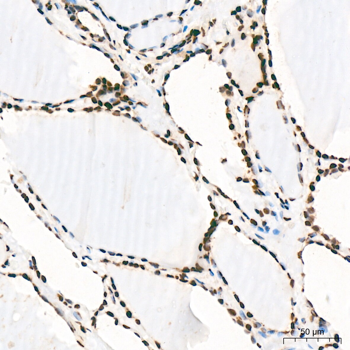 SNRPA1 Antibody (2D7M1)