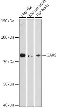 GARS Antibody (5Q5D7)
