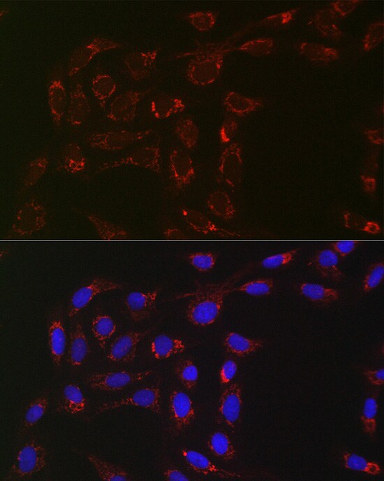 ACAA2 Antibody (8H6H5)