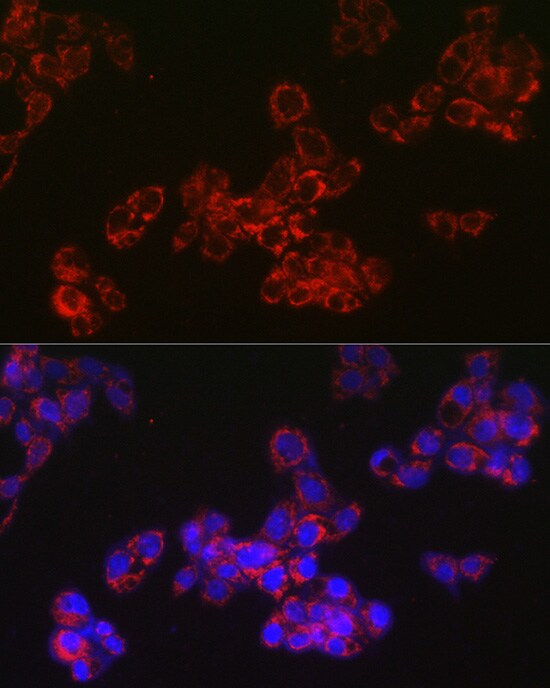 ACAA2 Antibody (8H6H5)