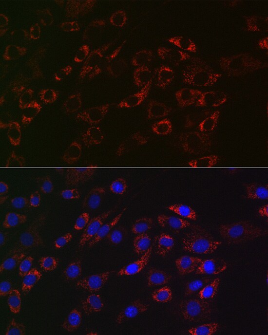 ACAA2 Antibody (8H6H5)