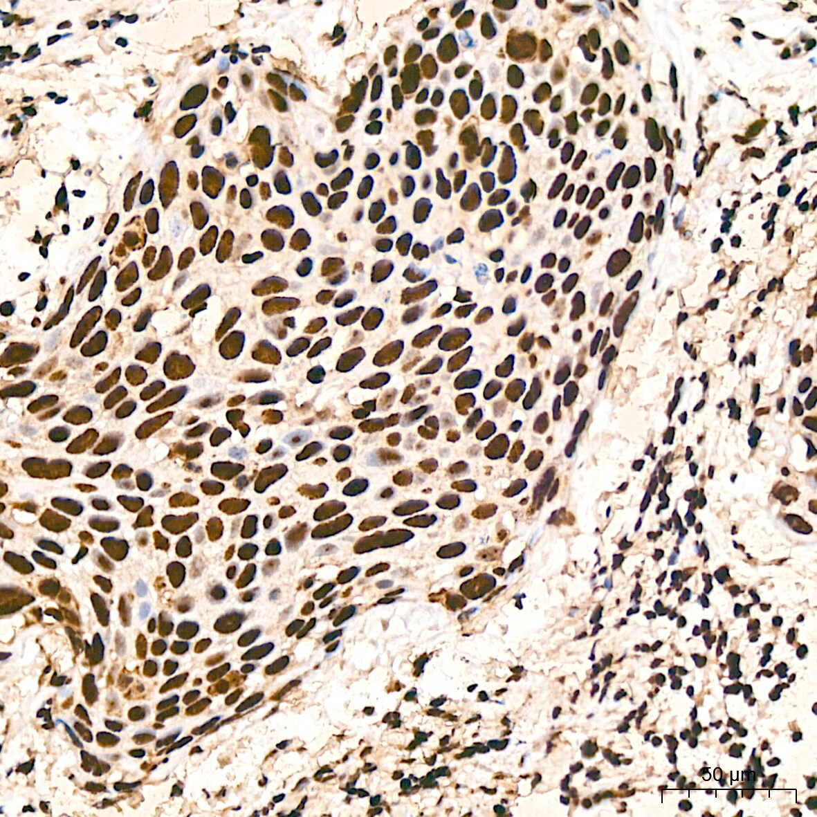 hnRNP K Antibody (3O5Y4)