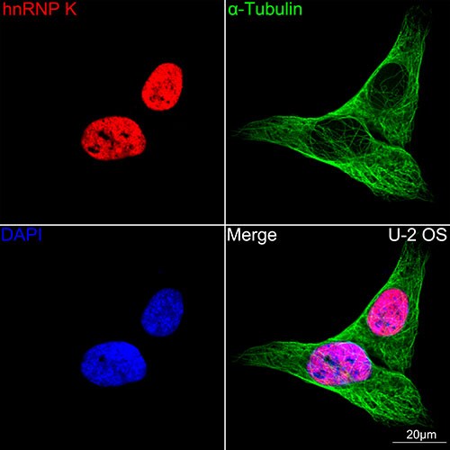 hnRNP K Antibody (3O5Y4)