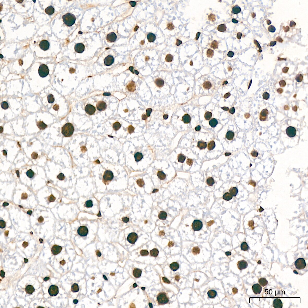 hnRNP K Antibody (3O5Y4)