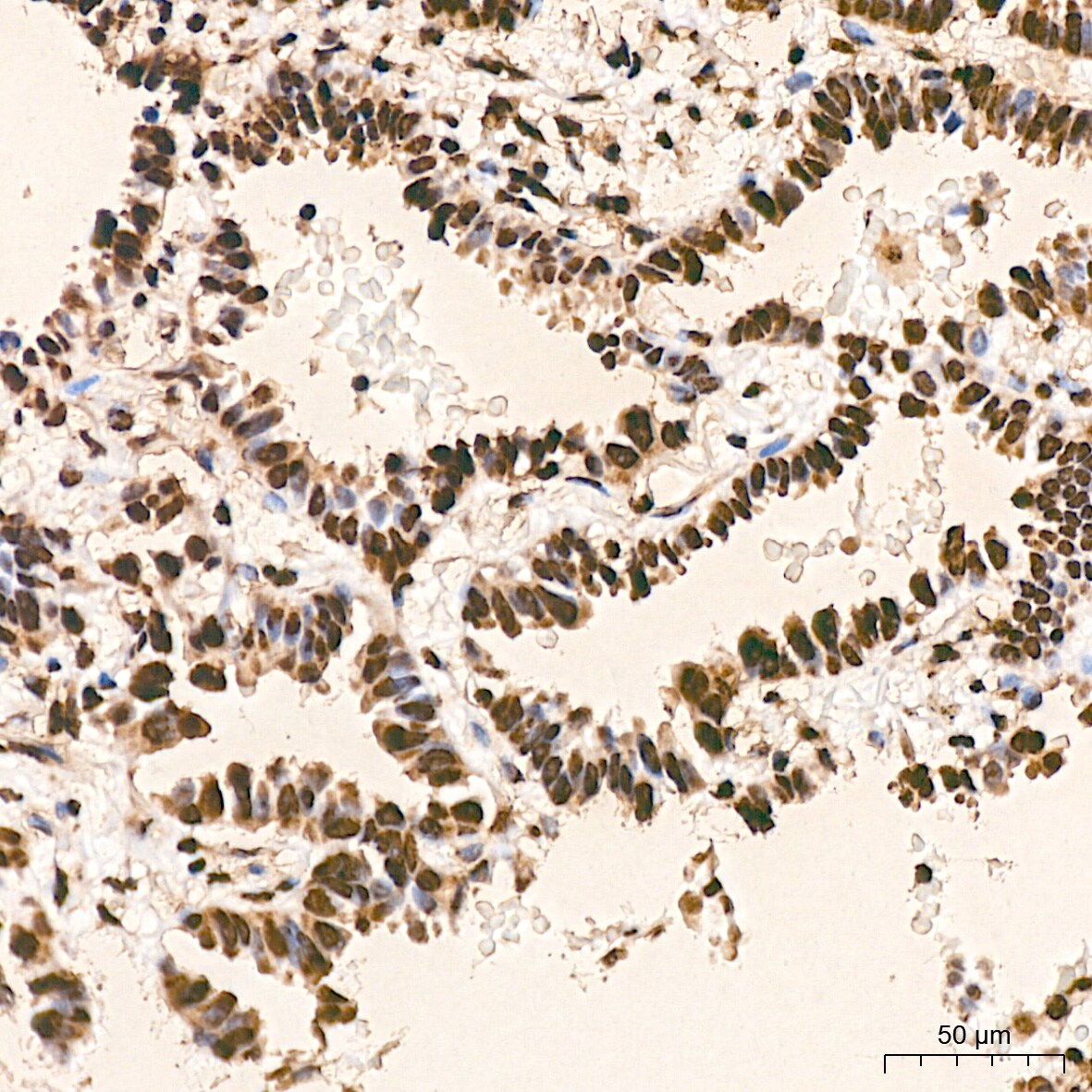 hnRNP K Antibody (3O5Y4)