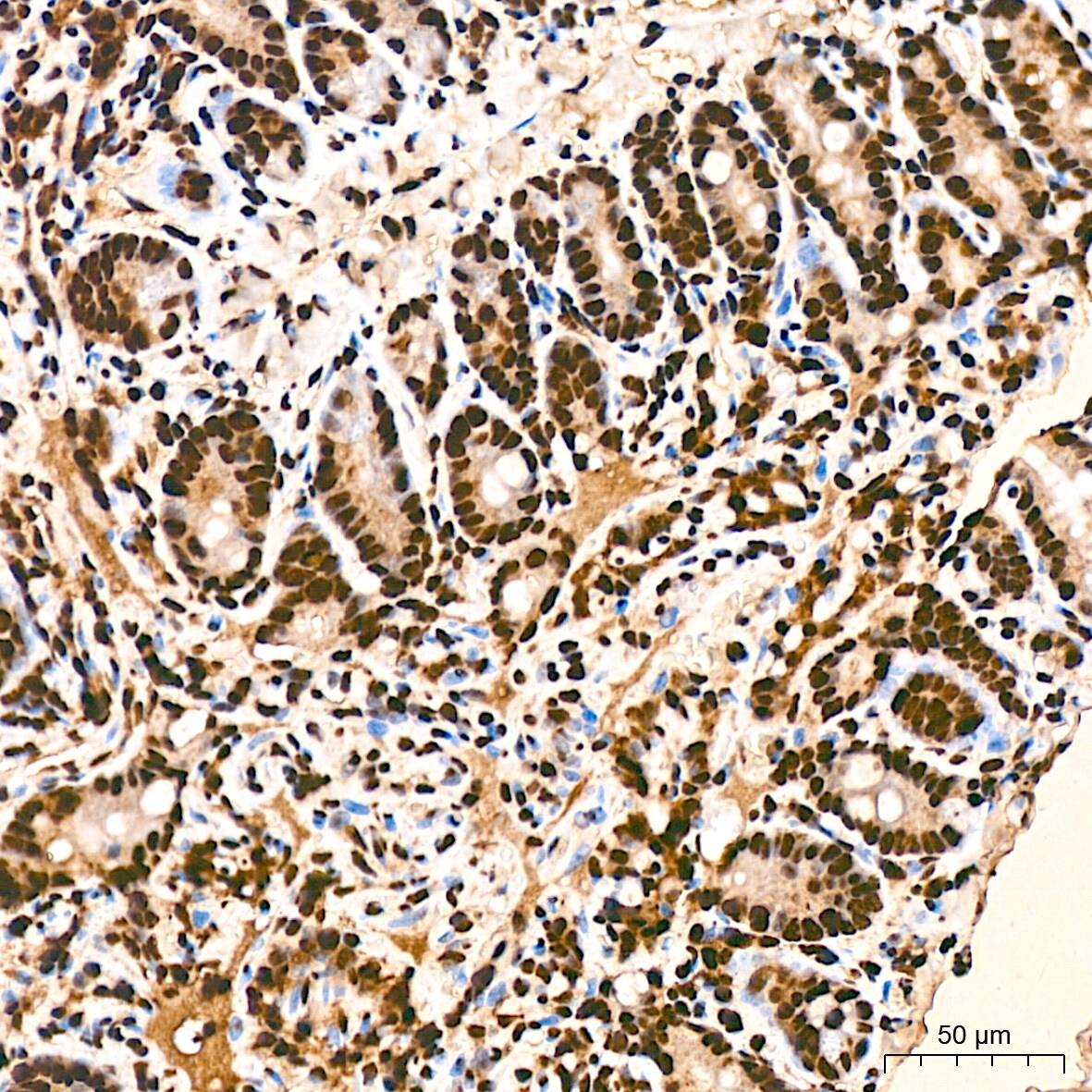 hnRNP K Antibody (3O5Y4)