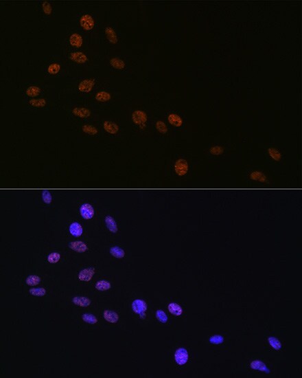 Matrin 3 Antibody (10O1D1)